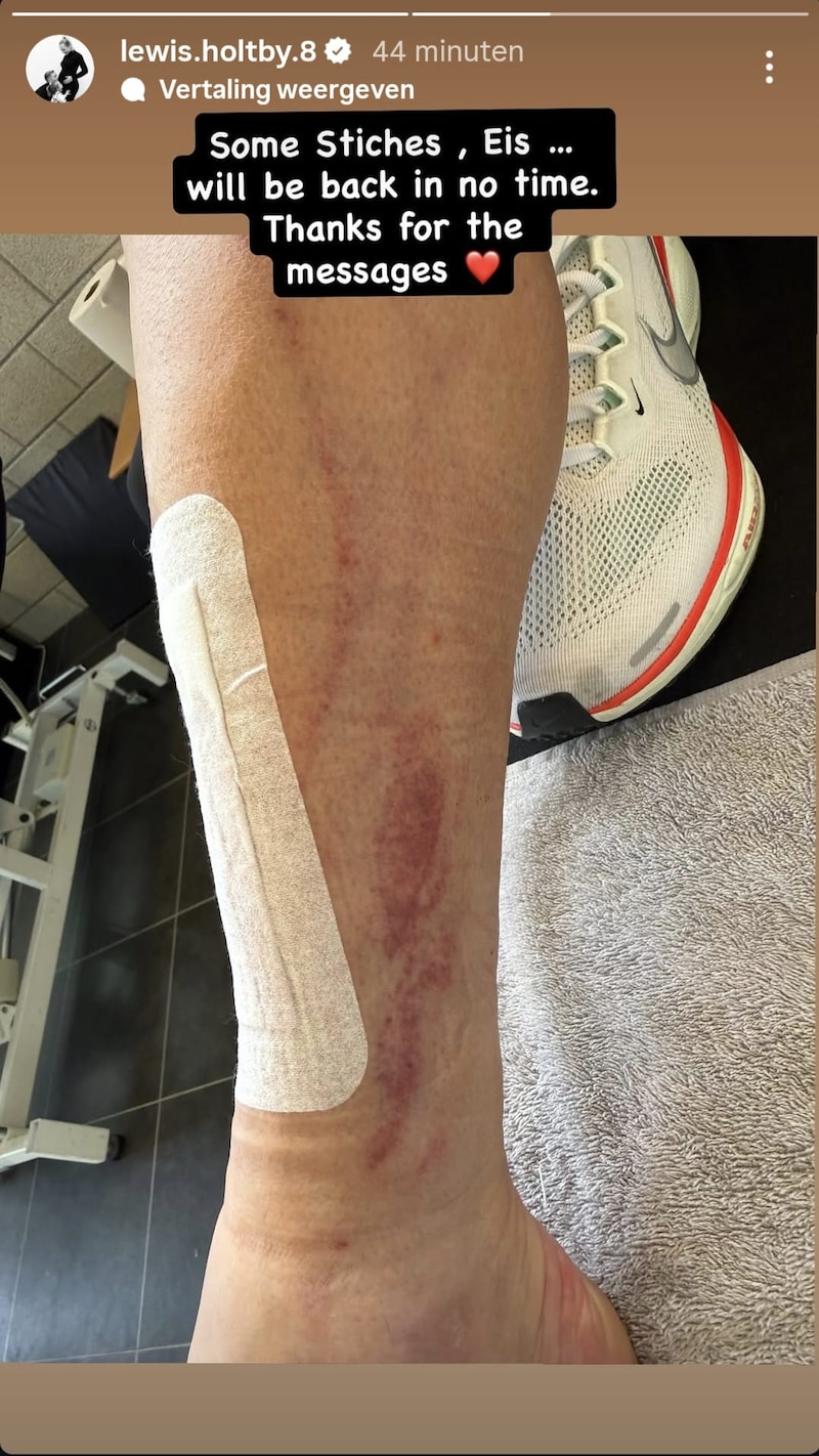 Update Cedera Lewis Holtby usai Dilukai Justin Hubner: Bintang Veteran Jerman Absen Berapa Lama?
            - galeri foto