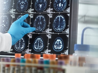 Vroeg testen helpt nauwelijks, bloeddruk laag houden is volgens de Gezondheidsraad de beste manier o